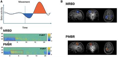 The neuromechanical of Beta-band corticomuscular coupling within the human motor system